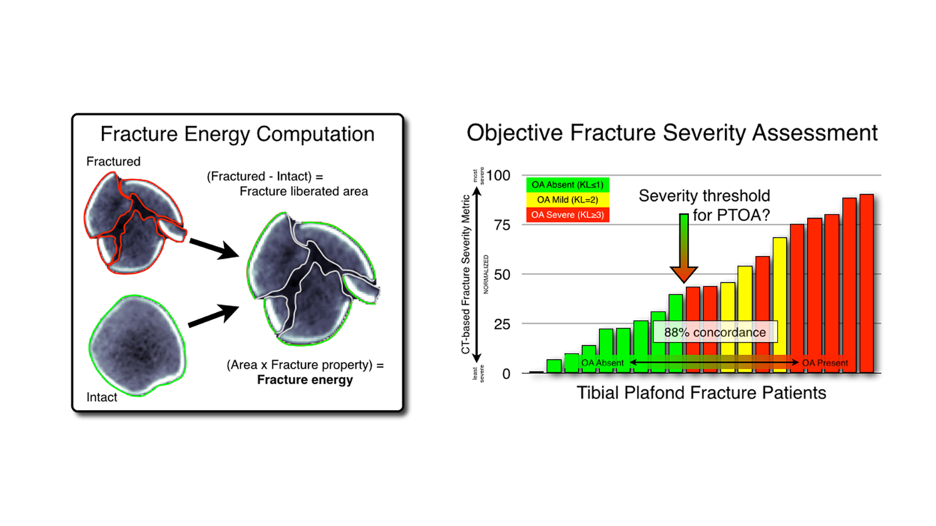 Objective CT-Based Assessment of Fracture Severity